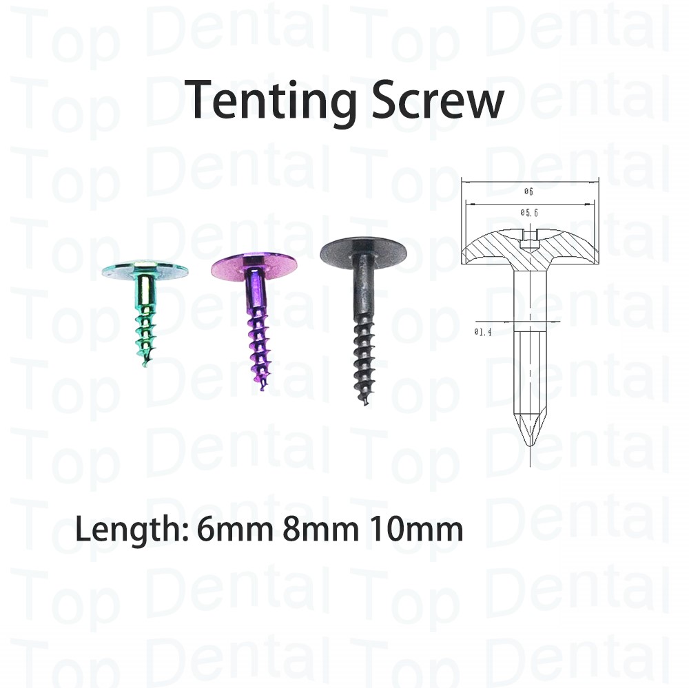 10pcs Dental GBR System Bone S - огляд і ціна Stabilizer Screw In